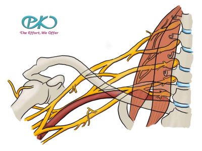 Brachial plexus injury