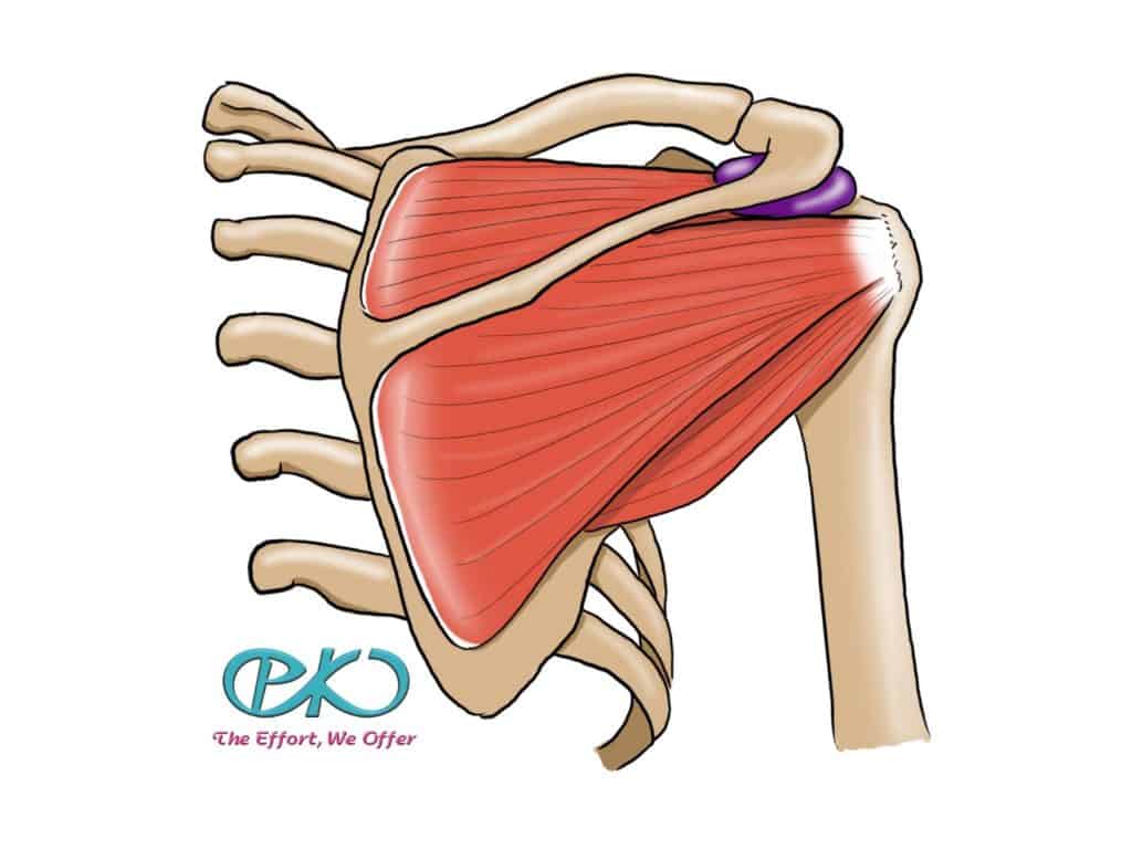 Shoulder impingement/Rotator cuff tendinitis เส้นเอ็นหัวไหล่อักเสบจาก